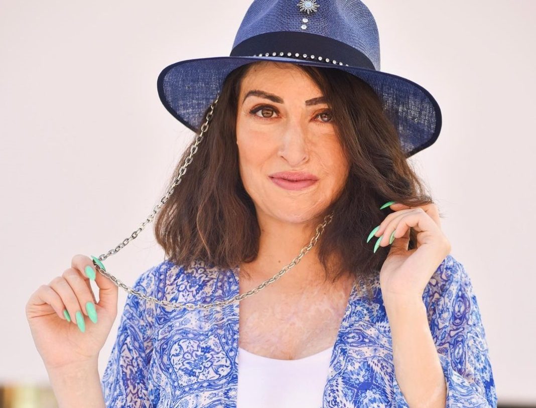 Δίκη για επίθεση με βιτριόλι στην Ιωάννα Παλιοσπύρου: Παραιτήθηκε από την έφεση η δράστις