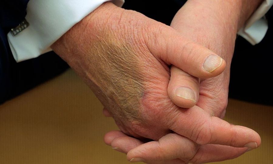 Ντόναλντ Τραμπ