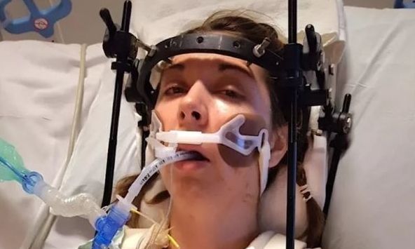 ΗΠΑ: «Αποκεφαλισμένη» γυναίκα υποβλήθηκε σε 37 επεμβάσεις για να της επανασυνδέσουν το κρανίο